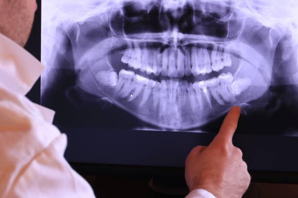 Best Emergency Denture Repair in Weed, CA