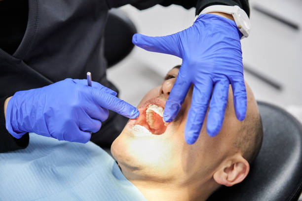 Best Emergency Tooth Extraction in Weed, CA
